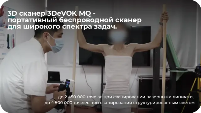 3D-сканирование 3DeVOK MQ и 3D-печать TPM3D: индивидуальные медицинские ортезы — фото 2